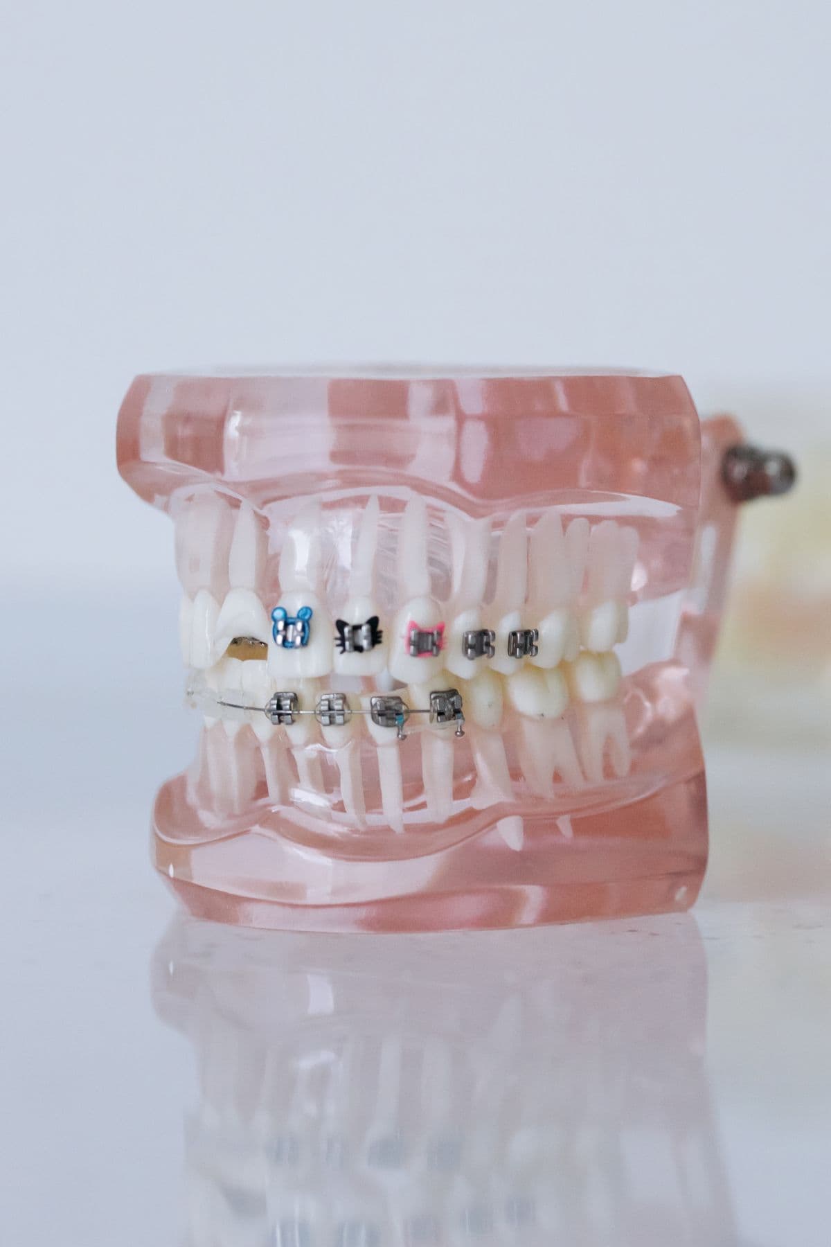 A close view of a clean, modern orthodontic office